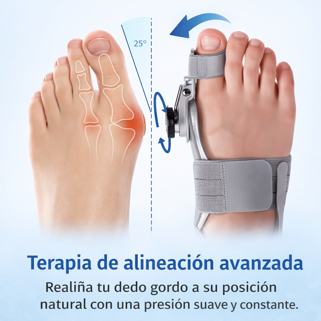 FlexStep™ La solución para los juanetes